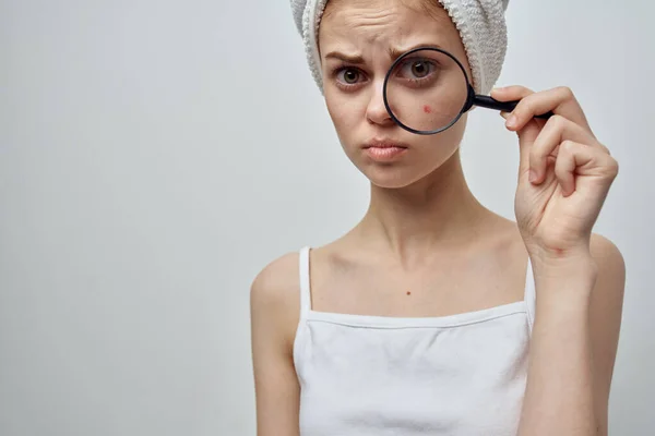 Csinos nő egy törülközővel a fejemen bőrproblémák közelkép — Stock Fotó
