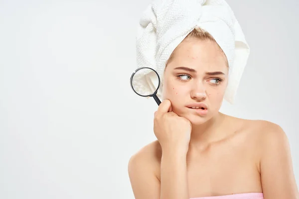 Bela mulher nua ombros acne tratamento Studio close-up — Fotografia de Stock