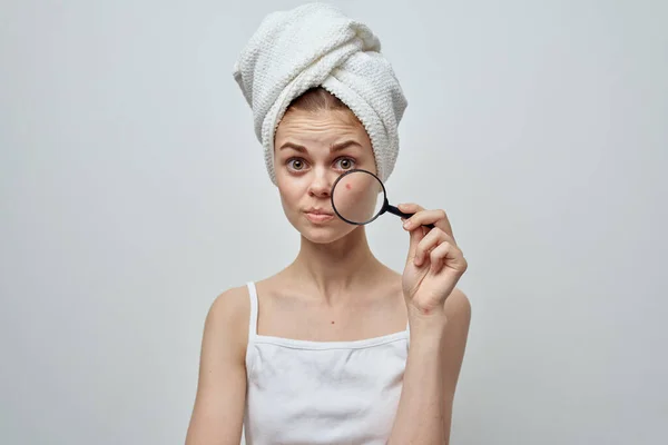 Mulher bonita com uma toalha na minha cabeça problemas de pele close-up — Fotografia de Stock