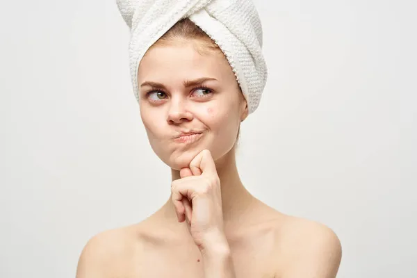 Красива жінка з прищами на обличчі косметологія Студія — стокове фото