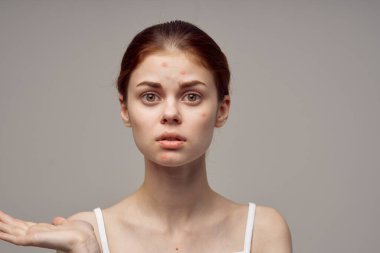 Güzel kadın yüz derisi problemleri dermatoloji açık arkaplan