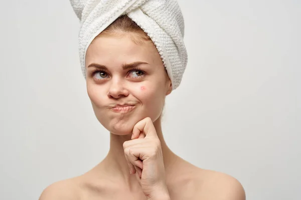 Femme avec un bouton sur le visage problèmes de peau gros plan — Photo