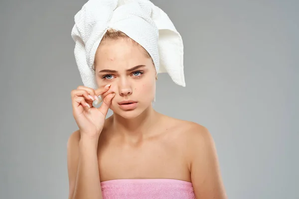 Vrouw blote schouders acne behandeling licht achtergrond — Stockfoto