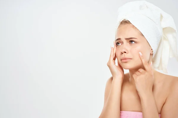 Csinos nő egy törülköző a fejemen pattanások az arcon bőrgyógyászat — Stock Fotó