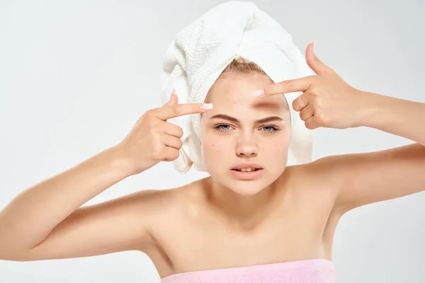 Жінка з рушником на голові проблеми зі шкірою обличчя Студія крупним планом — стокове фото
