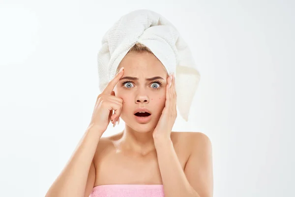 Mulher com uma toalha na minha cabeça problemas de pele facial dermatologia descontentamento — Fotografia de Stock