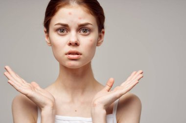 Güzel kadın yüz derisi problemleri dermatoloji açık arkaplan