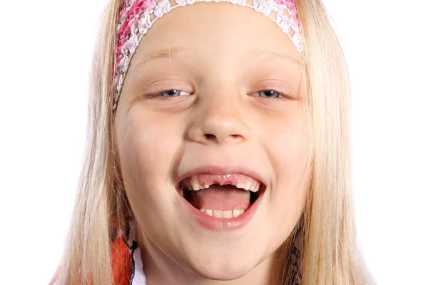 Little girl with missing front teeth — Stock Photo, Image