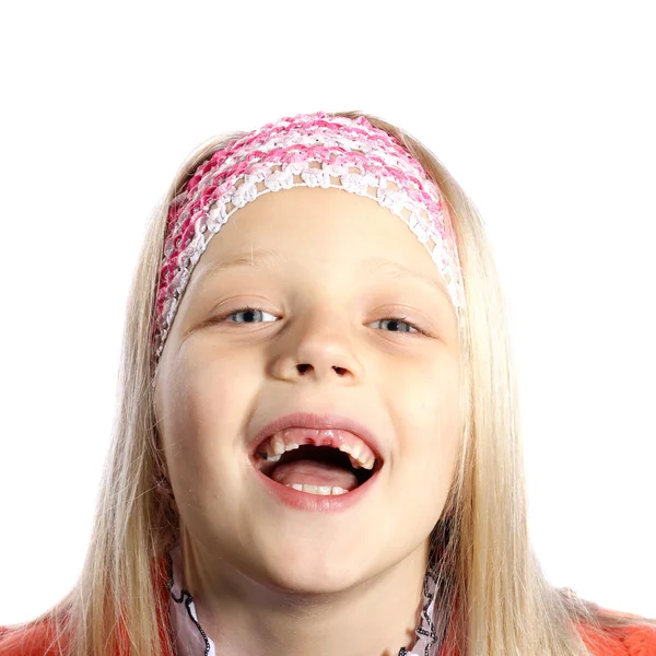 Little girl with missing front teeth — Stock Photo, Image