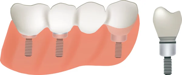 Zahnarzt — Stockvektor