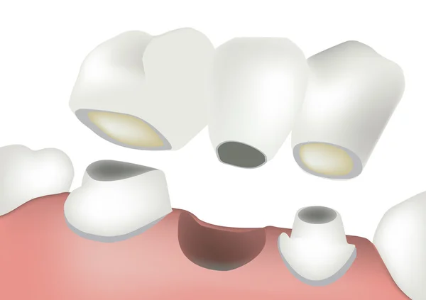 Arbeitender Zahnarzt — Stockvektor