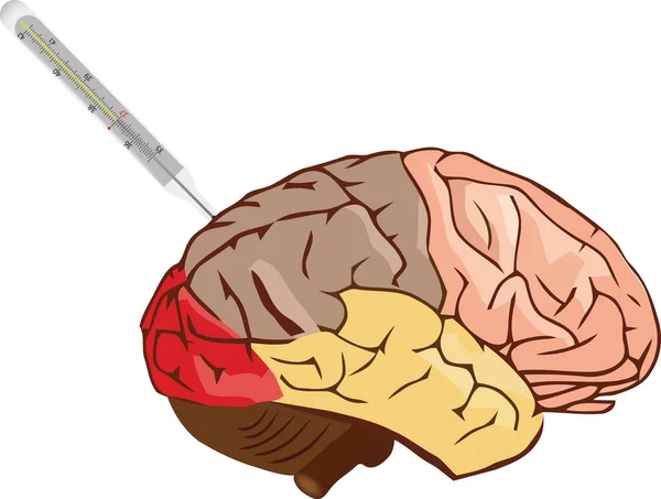 Menschliches Gehirn Wird Mit Einem Messer Durchtrennt — Stockvektor