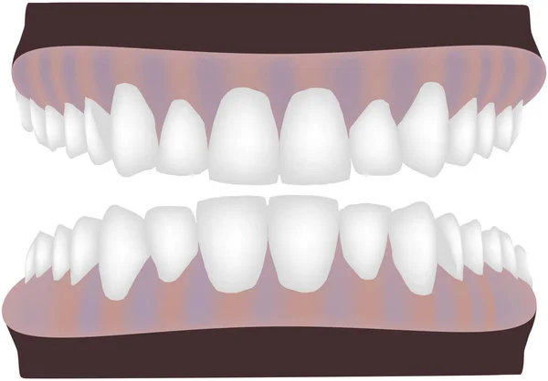 Paladar superior e inferior aparato dental prótesis dental- — Vector de stock