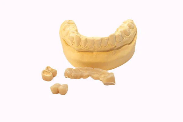 Plaster Impression Dental Apparatus — Stock Photo, Image