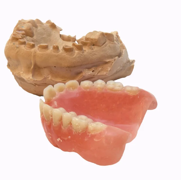Impressão Gesso Aparelho Dentário — Fotografia de Stock