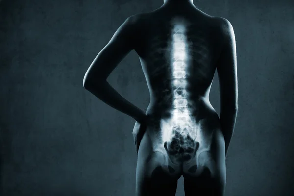 Хребет человека в рентгене — стоковое фото