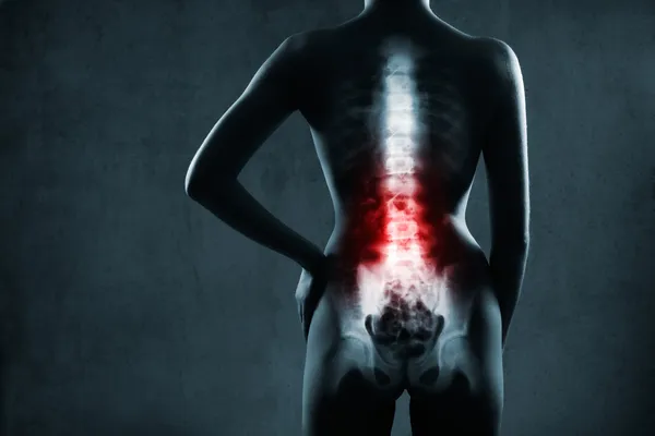 Espina dorsal humana en rayos X —  Fotos de Stock
