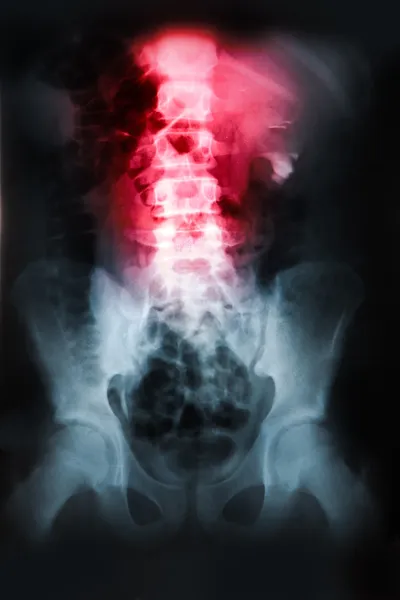 Röntgen des Beckens und der Wirbelsäule — Stockfoto