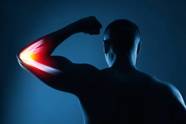 Mänsklig Armbåge Gemensamma Röntgen Blå Bakgrund Handen Markerad Med Gul — Stockfoto