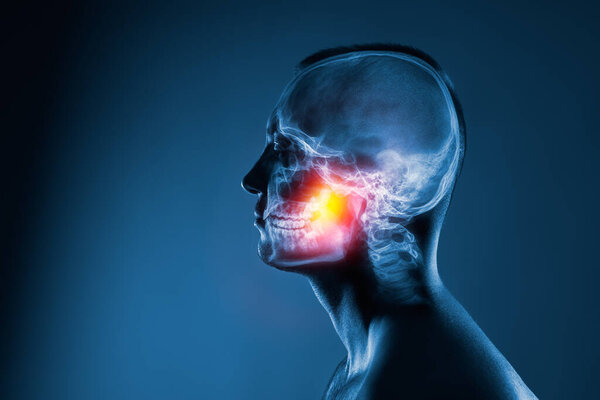 X-ray of a mans head on blue background. Jaw joint is highlighted by yellow red colour.