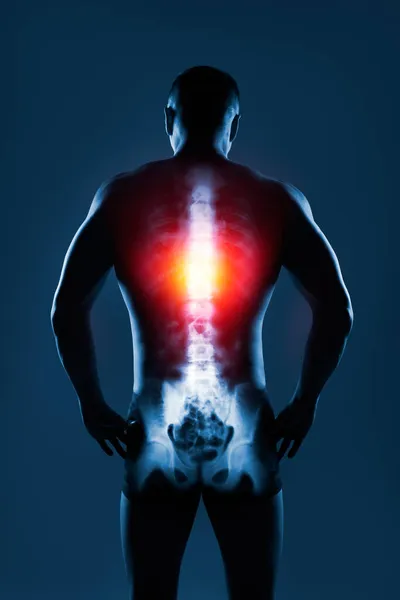 Menschliche Wirbelsäule Röntgenbild Auf Blauem Hintergrund Die Brustwirbelsäule Ist Gelb — Stockfoto