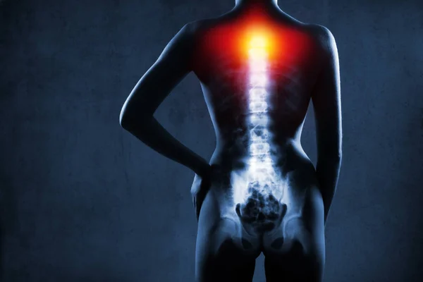 Menschliche Wirbelsäule Röntgenbild Auf Blauem Hintergrund Die Halswirbelsäule Ist Rot — Stockfoto
