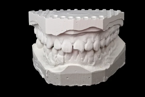Diş izlenim tebeşir modeli — Stok fotoğraf
