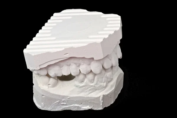 Dental impression chalk model — Stock Photo, Image