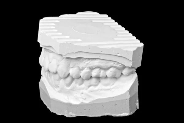 Modello di gesso impressione dentale — Foto Stock