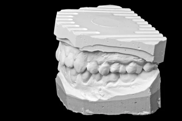 Modello di gesso impressione dentale — Foto Stock