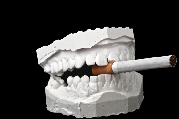 Стоматологическая модель с сигаретой — стоковое фото