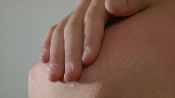 Boy peeling skin — Stock Video