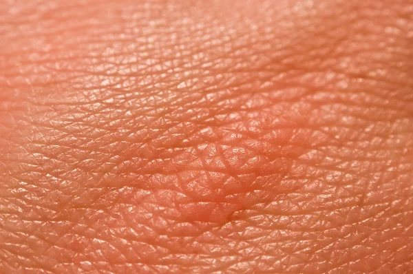 Human skin macro picture — Stock Photo, Image