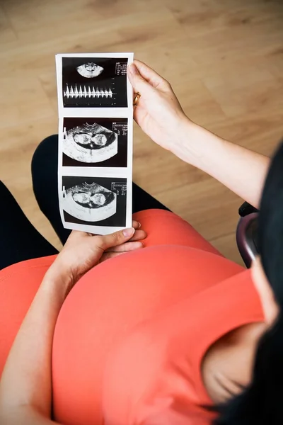 Gravid kvinna som tittar på en ultraljudsundersökning — Stockfoto