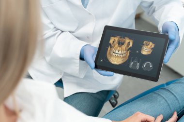 Klinikte diş muayenesi. Diş hekimi dijital tablet ekranda diş röntgeni gösteriyor. 3D tomografi teknolojisi.