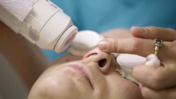 Patient undergoing skin treatment with a laser — Stock Video