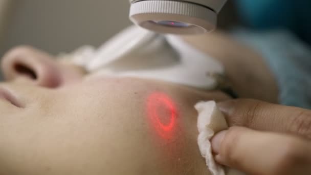 Procedimento cosmético com laser . — Vídeo de Stock