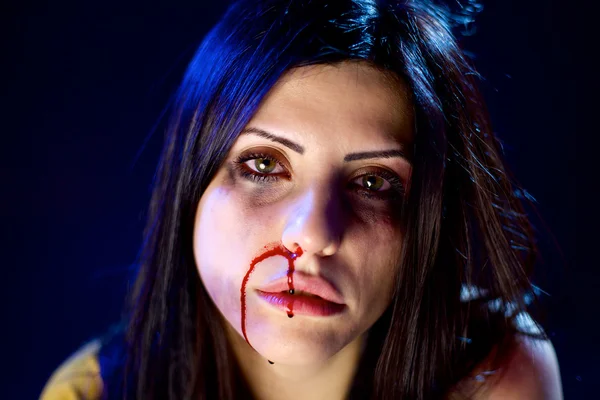 Женщина с кровотечением из носа после домашнего насилия — стоковое фото