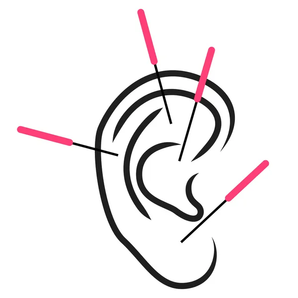 Illustration de l'acupuncture de l'oreille — Image vectorielle