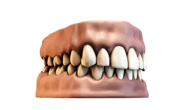 Teeth with gums — Stock Photo, Image