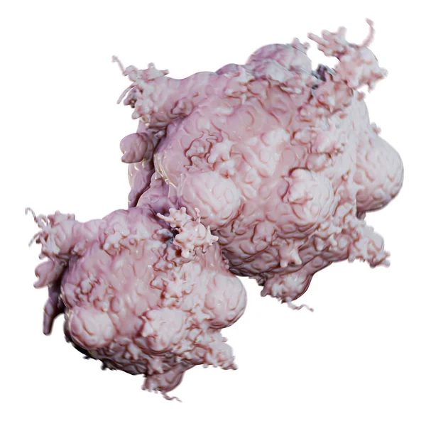 Tumor Mass Isolated White Background Illustration — Fotografia de Stock