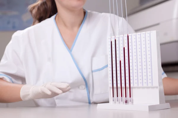 Mulher médica fazendo teste de velocidade de hemossedimentação — Fotografia de Stock