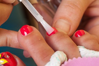 Pedikür prosedürü