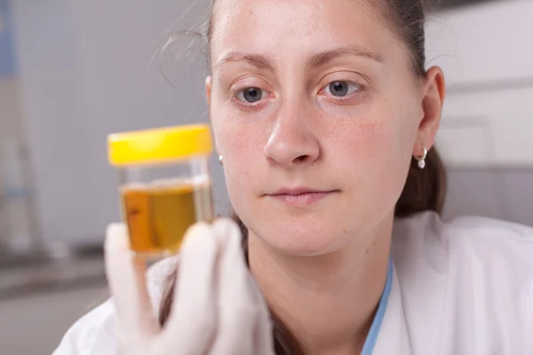 Woman examine urine container — Stock Photo, Image