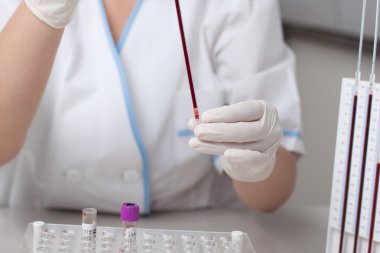 Eritrosit sedimentasyon hızı testi yapıyor doktor kadın