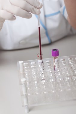 Eritrosit sedimentasyon hızı testi yapıyor doktor kadın