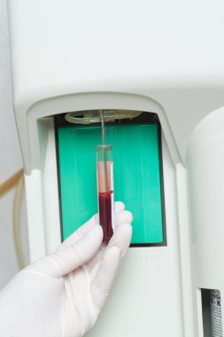 kadın performin hematolojik testi.