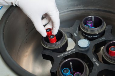 ellerinde eldiven santrifüj yükleniyor