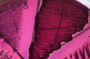 Petri kabındaki bakteriler