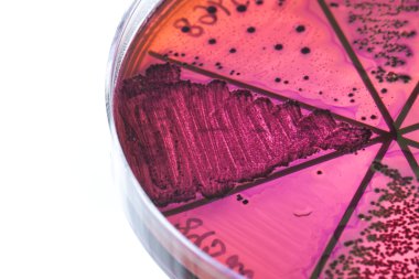 Petri kabındaki bakteriler